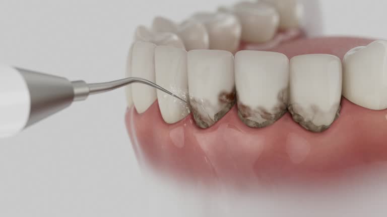 Reliable Teeth Cleaning And Checkup contractor in Union County County, MS by Dentist Open Now